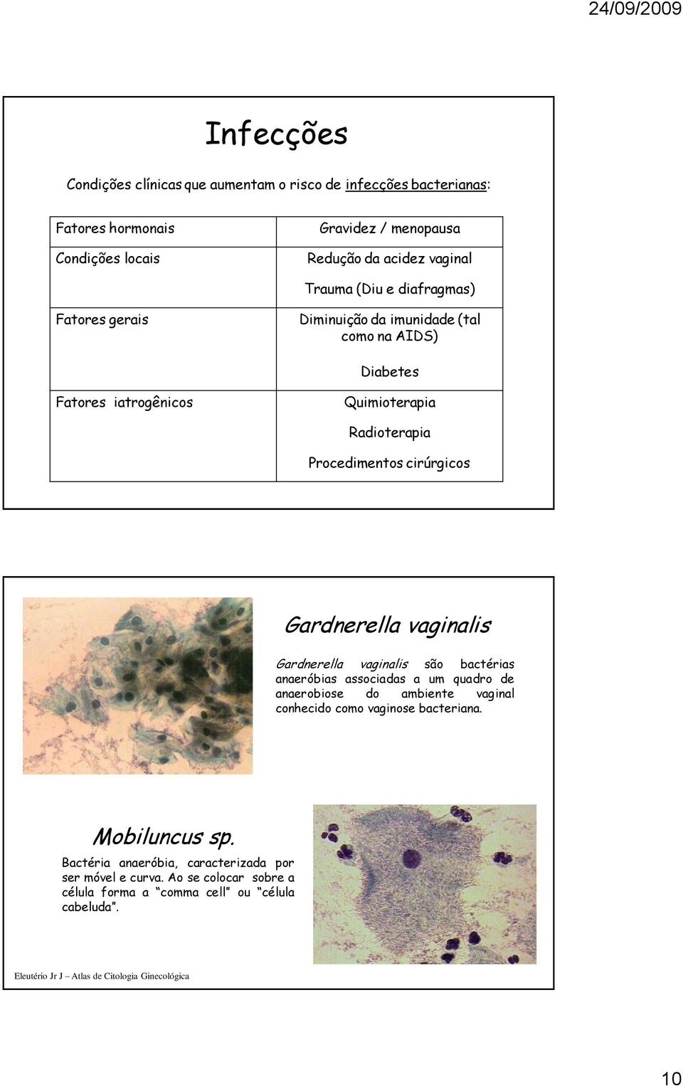 cirúrgicos Gardnerella vaginalis Gardnerella vaginalis são bactérias anaeróbias associadas a um quadro de anaerobiose do ambiente vaginal conhecido como