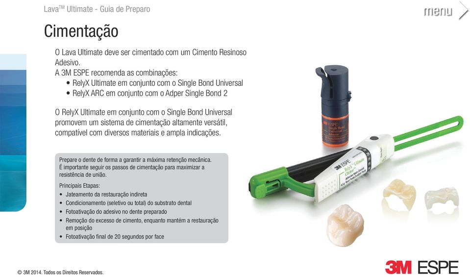 promovem um sistema de cimentação altamente versátil, compatível com diversos materiais e ampla indicações. Prepare o dente de forma a garantir a máxima retenção mecânica.