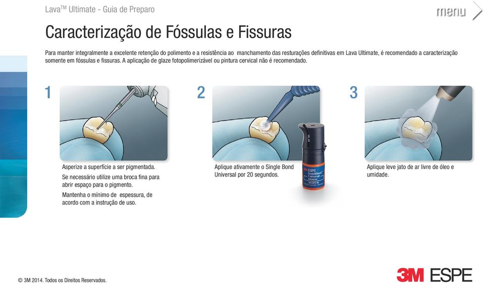 A aplicação de glaze fotopolimerizável ou pintura cervical não é recomendado. 1 2 3 Asperize a superfície a ser pigmentada.