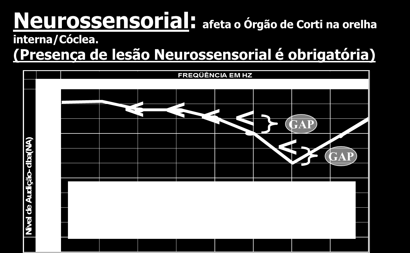 Quatro características do Padrão PAIR 1ª Característica-Perda Neurossensorial Se ausente, não é PAIR.