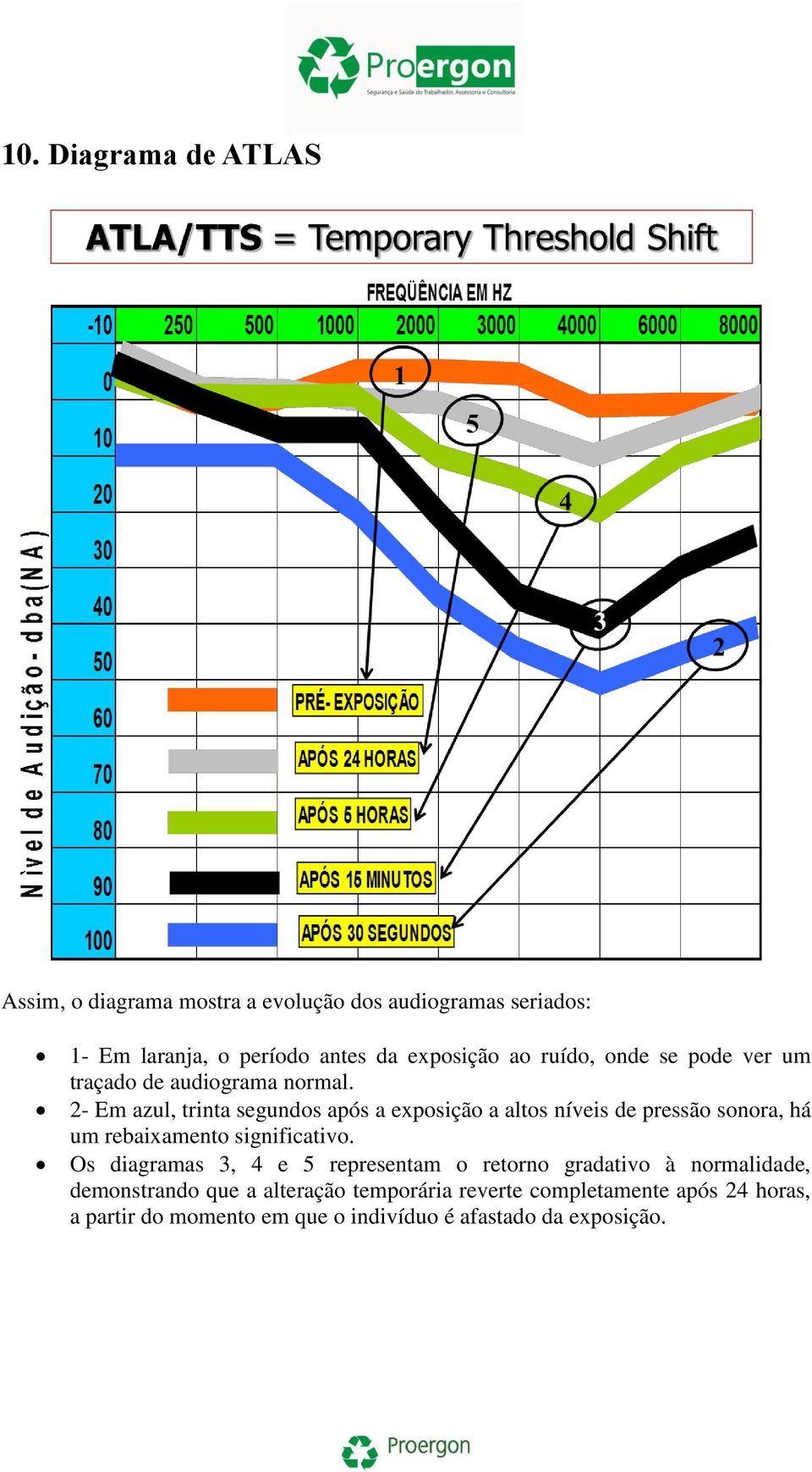 2- Em azul, trinta segundos após a exposição a altos níveis de pressão sonora, há um rebaixamento significativo.