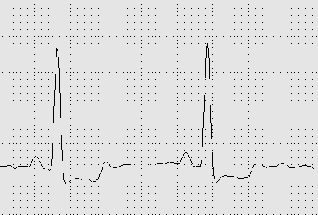 Frequência cardíaca 0.1s 0.