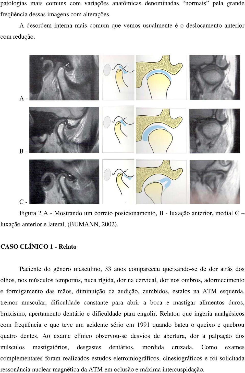 A - B - C - Figura 2 A - Mostrando um correto posicionamento, B - luxação anterior, medial C luxação anterior e lateral, (BUMANN, 2002).