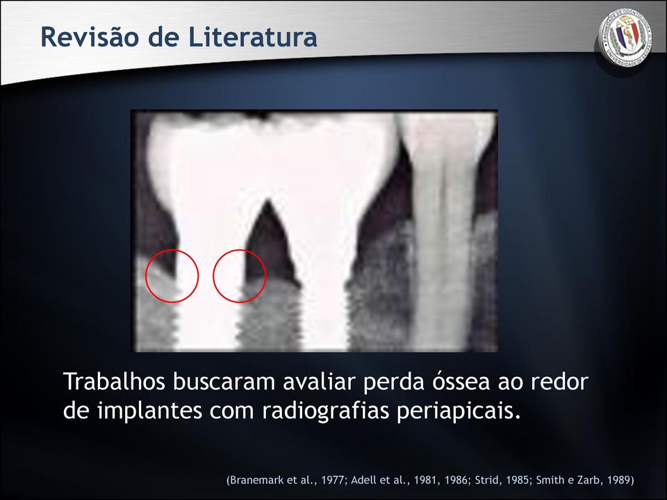 radiografias periapicais. (Branemark et al.