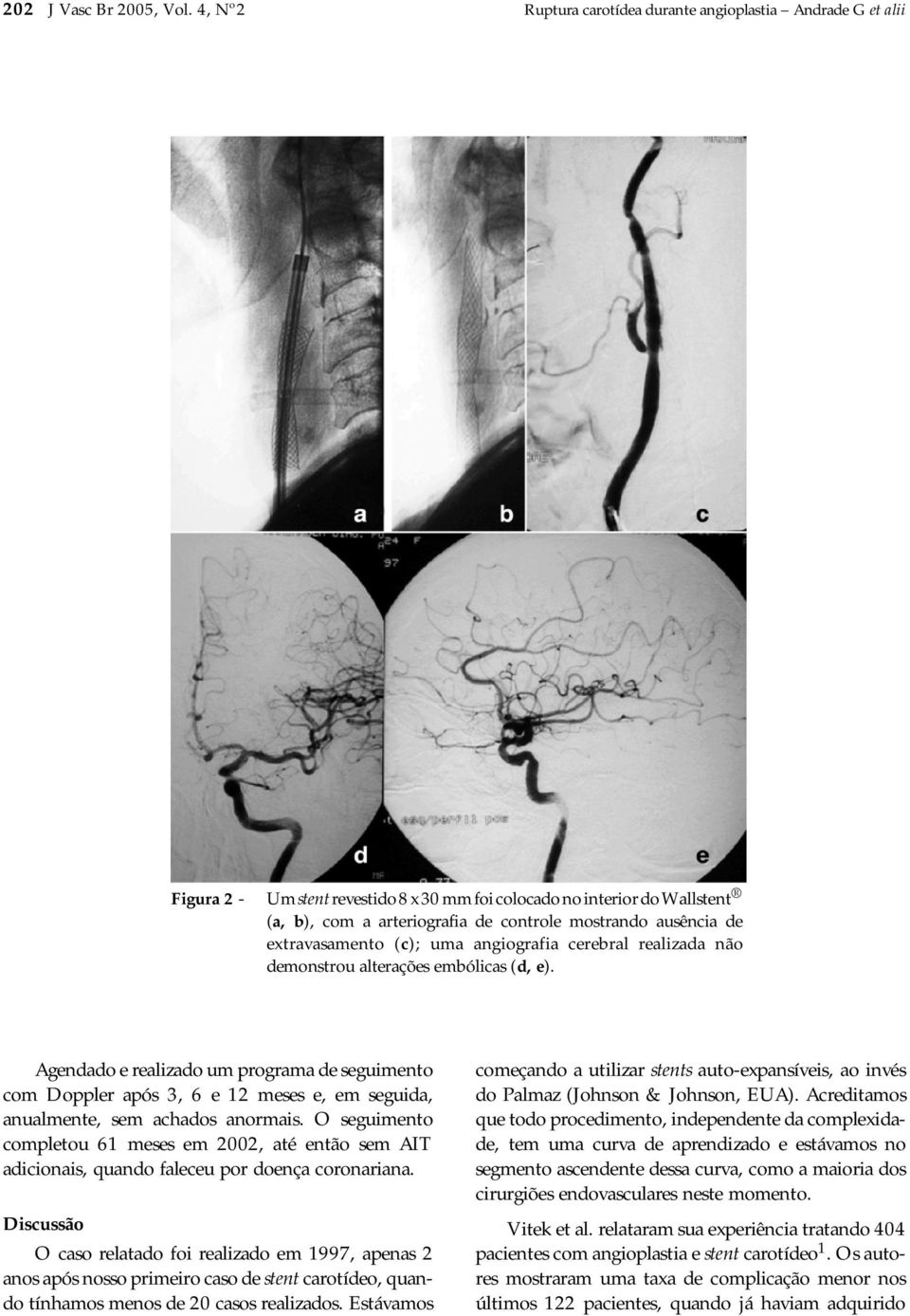 ausência de extravasamento (c); uma angiografia cerebral realizada não demonstrou alterações embólicas (d, e).