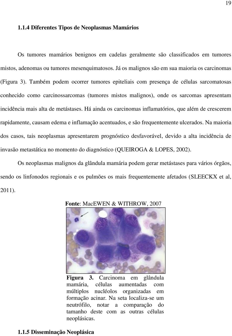 Também podem ocorrer tumores epiteliais com presença de células sarcomatosas conhecido como carcinossarcomas (tumores mistos malignos), onde os sarcomas apresentam incidência mais alta de metástases.