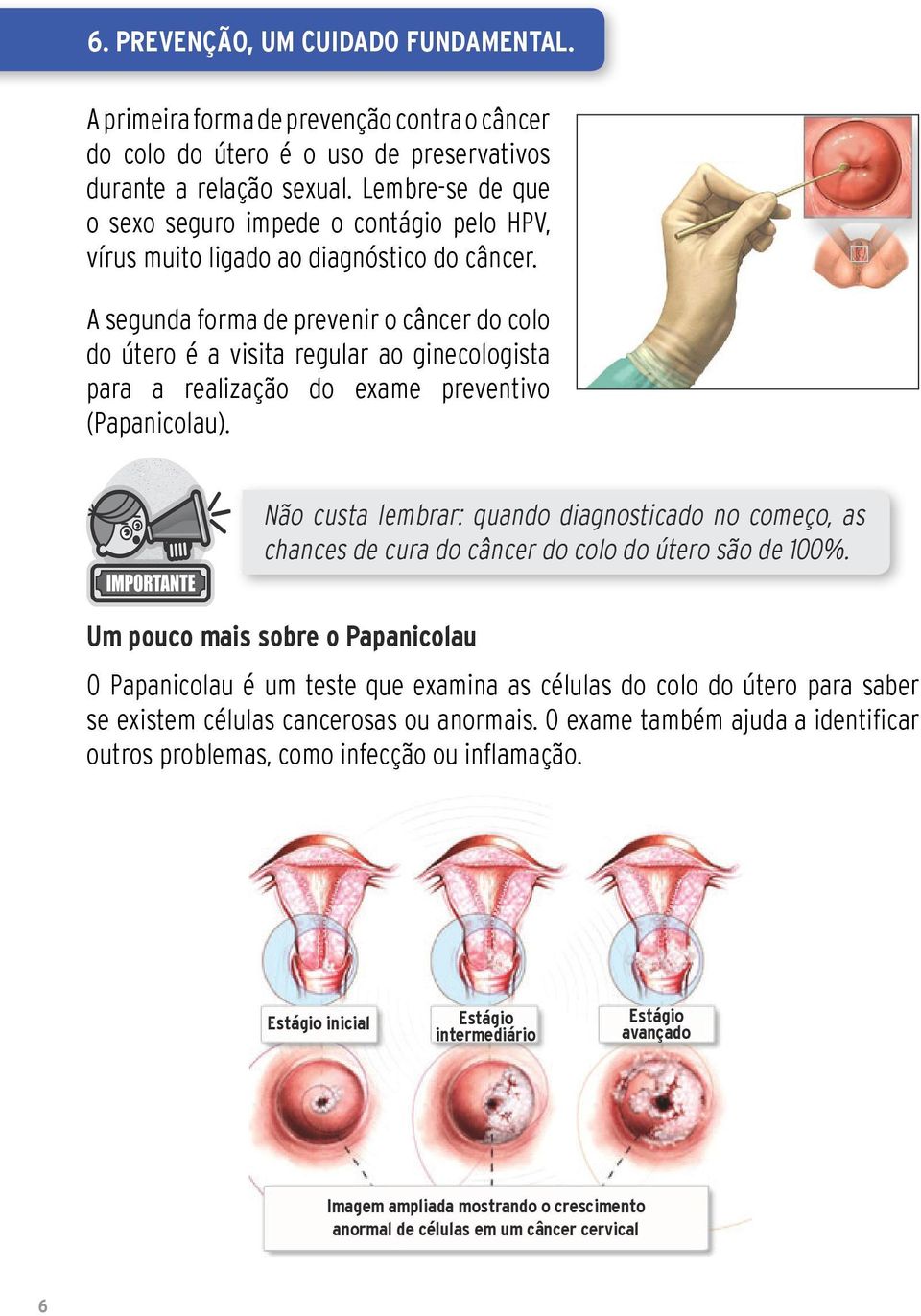 A segunda forma de prevenir o câncer do colo do útero é a visita regular ao ginecologista para a realização do exame preventivo (Papanicolau).