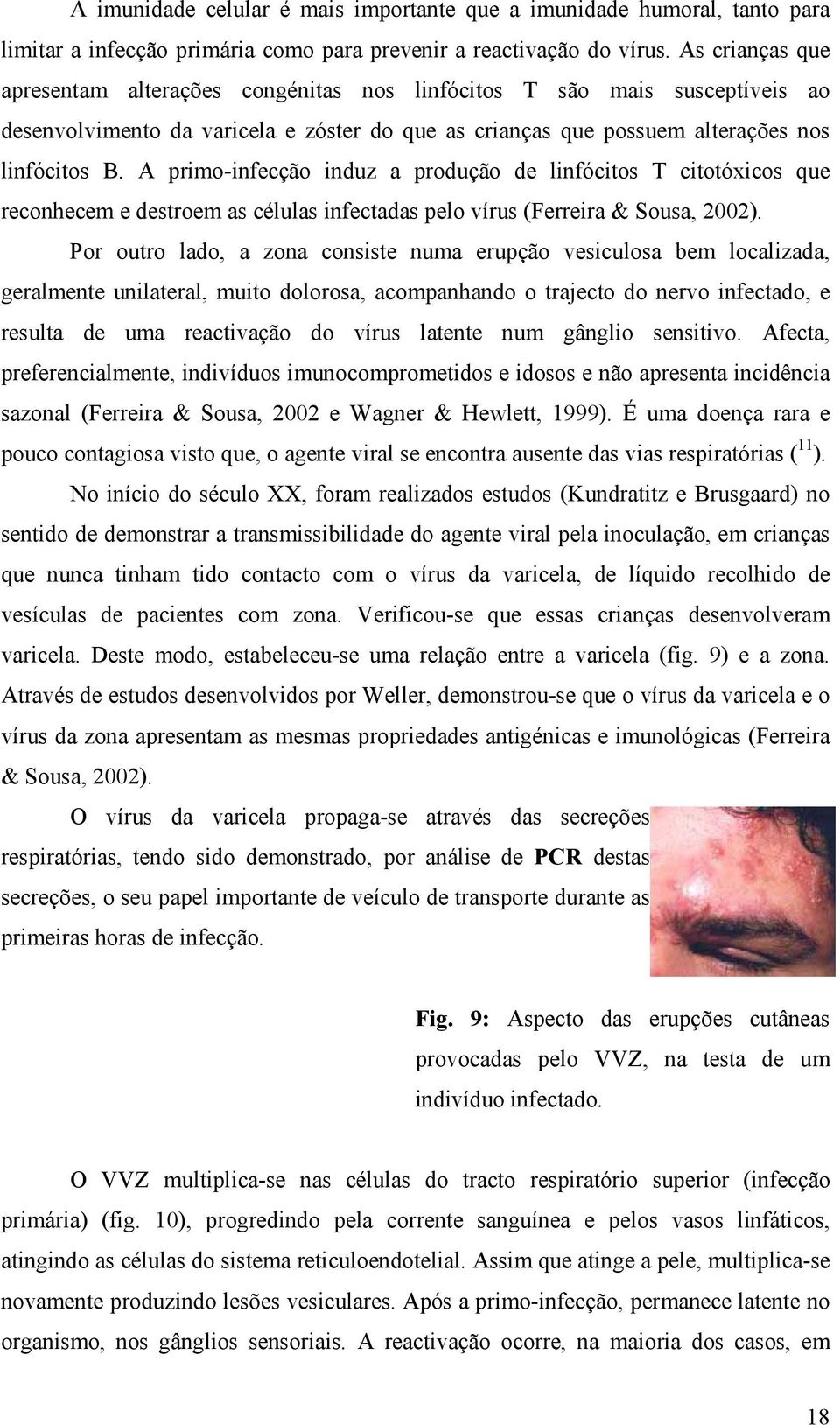 A primo-infecção induz a produção de linfócitos T citotóxicos que reconhecem e destroem as células infectadas pelo vírus (Ferreira & Sousa, 2002).