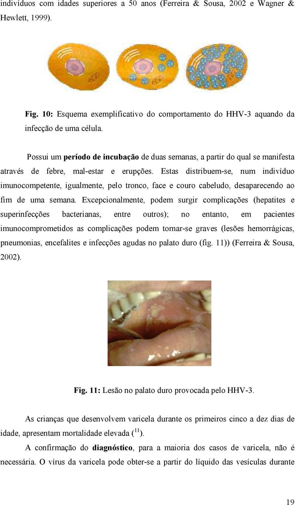 Estas distribuem-se, num indivíduo imunocompetente, igualmente, pelo tronco, face e couro cabeludo, desaparecendo ao fim de uma semana.