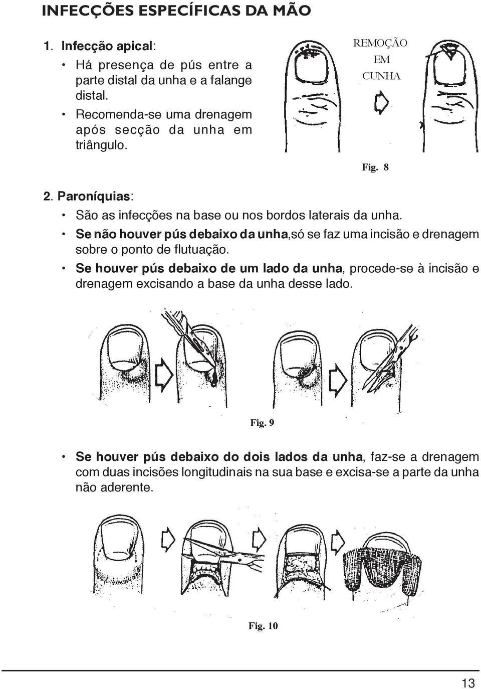 Se não houver pús debaixo da unha,só se faz uma incisão e drenagem sobre o ponto de flutuação.