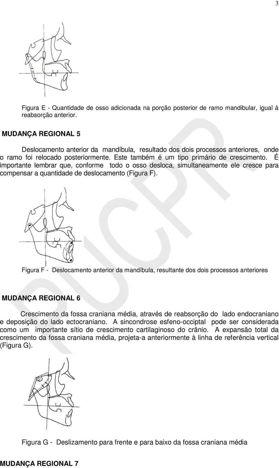 É importante lembrar que, conforme todo o osso desloca, simultaneamente ele cresce para compensar a quantidade de deslocamento (Figura F).