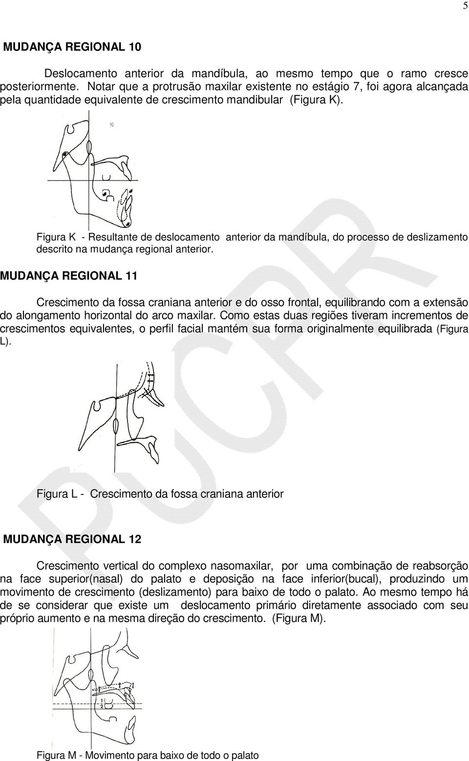 Figura K - Resultante de deslocamento anterior da mandíbula, do processo de deslizamento descrito na mudança regional anterior.