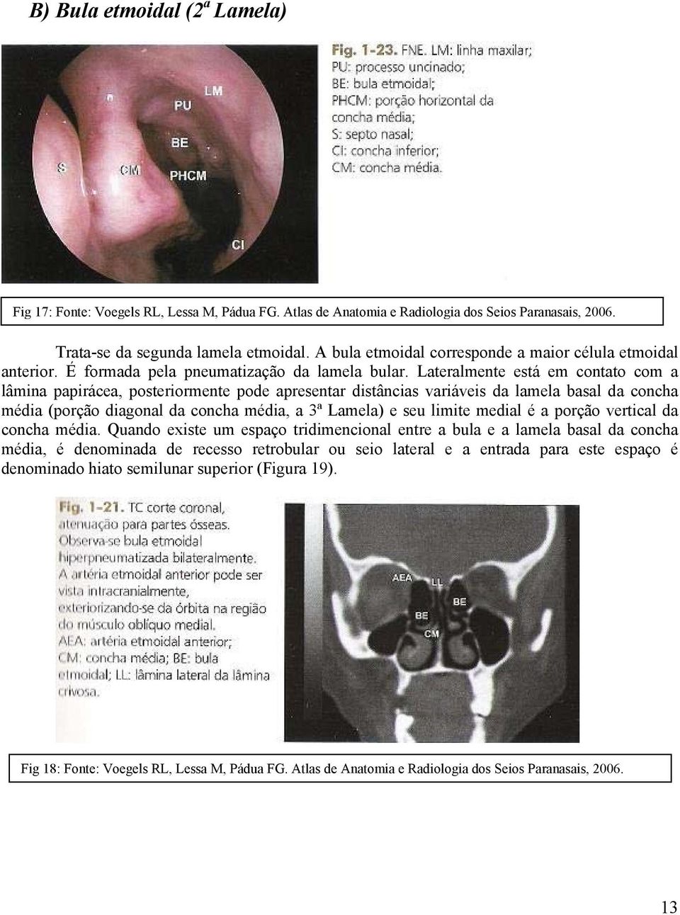 Lateralmente está em contato com a lâmina papirácea, posteriormente pode apresentar distâncias variáveis da lamela basal da concha média (porção diagonal da concha média, a 3ª Lamela) e seu limite