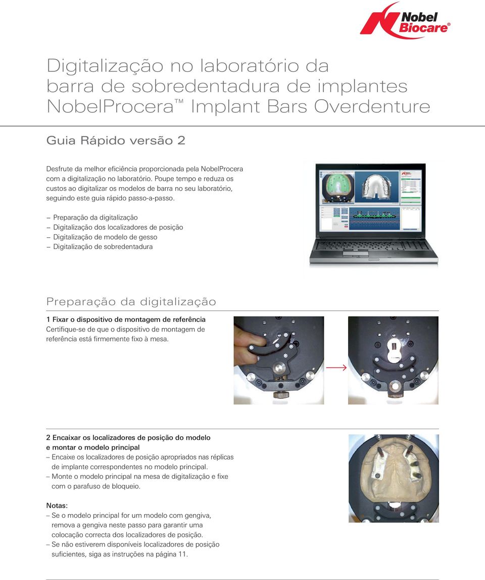 Preparação da digitalização Digitalização dos localizadores de posição Digitalização de modelo de gesso Digitalização de sobredentadura Preparação da digitalização 1 Fixar o dispositivo de montagem