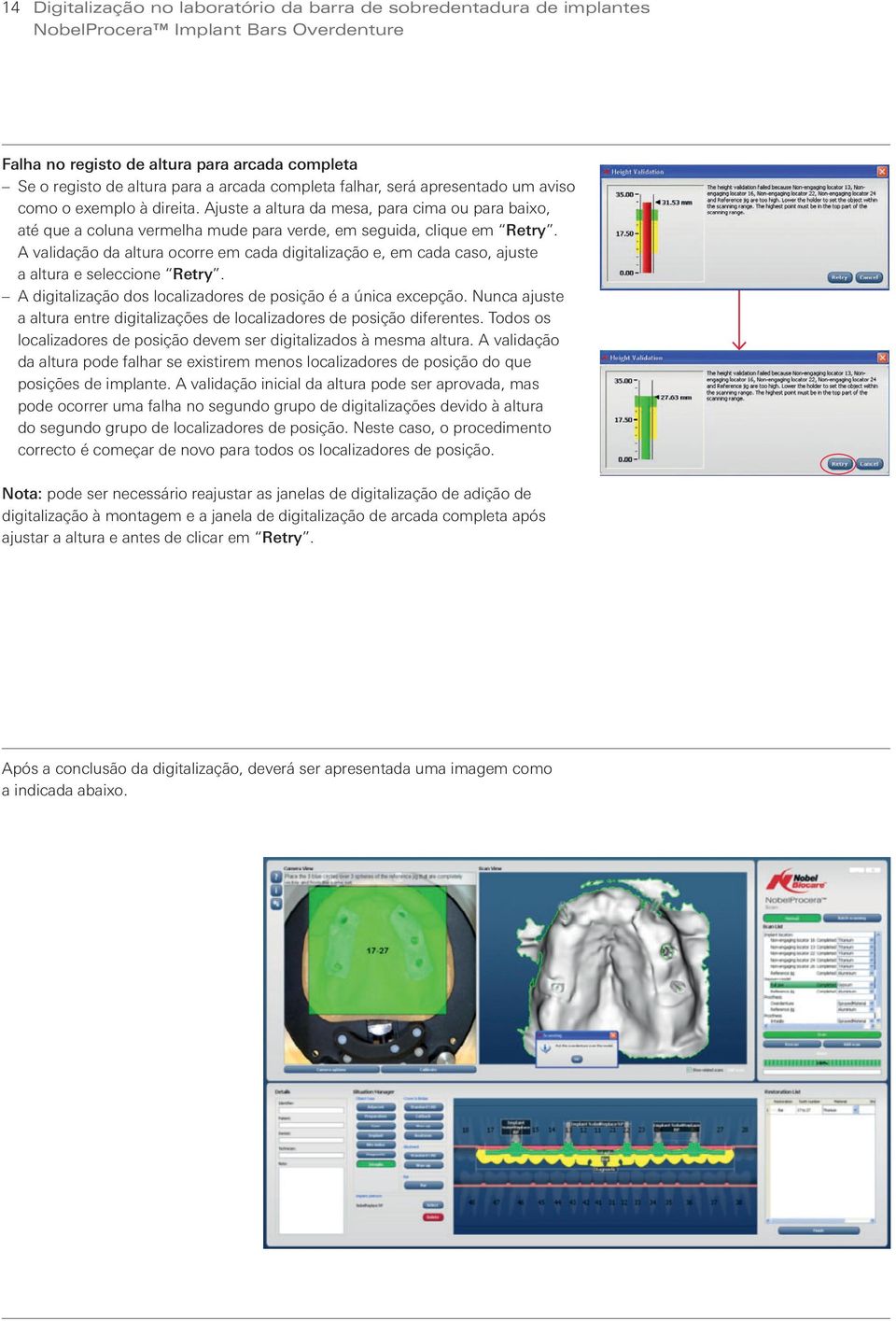 A validação da altura ocorre em cada digitalização e, em cada caso, ajuste a altura e seleccione Retry. A digitalização dos localizadores de posição é a única excepção.