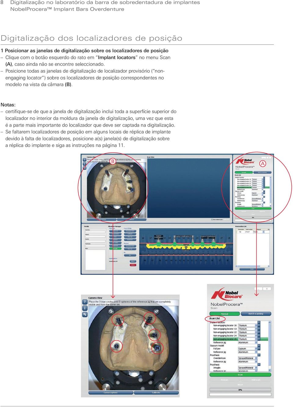 Posicione todas as janelas de digitalização de localizador provisório ( nonengaging locator ) sobre os localizadores de posição correspondentes no modelo na vista da câmara (B).