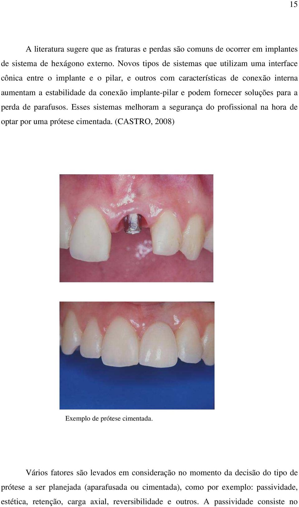 e podem fornecer soluções para a perda de parafusos. Esses sistemas melhoram a segurança do profissional na hora de optar por uma prótese cimentada.