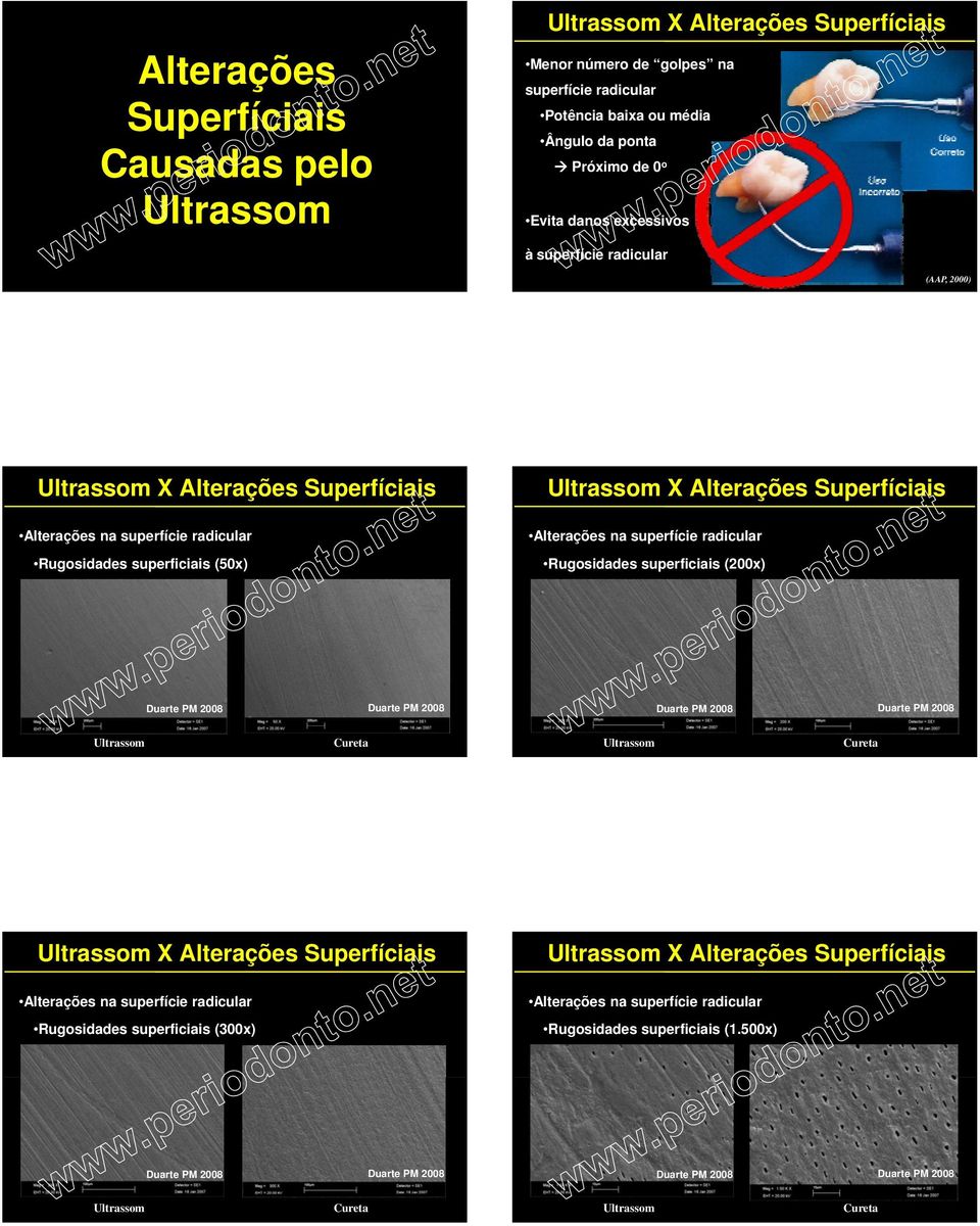 radicular Rugosidades superficiais (200x) Duarte PM 2008 Duarte PM 2008 Duarte PM 2008 Duarte PM 2008 Ultrassom Cureta Ultrassom Cureta Ultrassom X Alterações Superfíciais Alterações na superfície