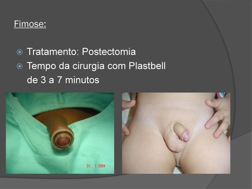 da cirurgia com