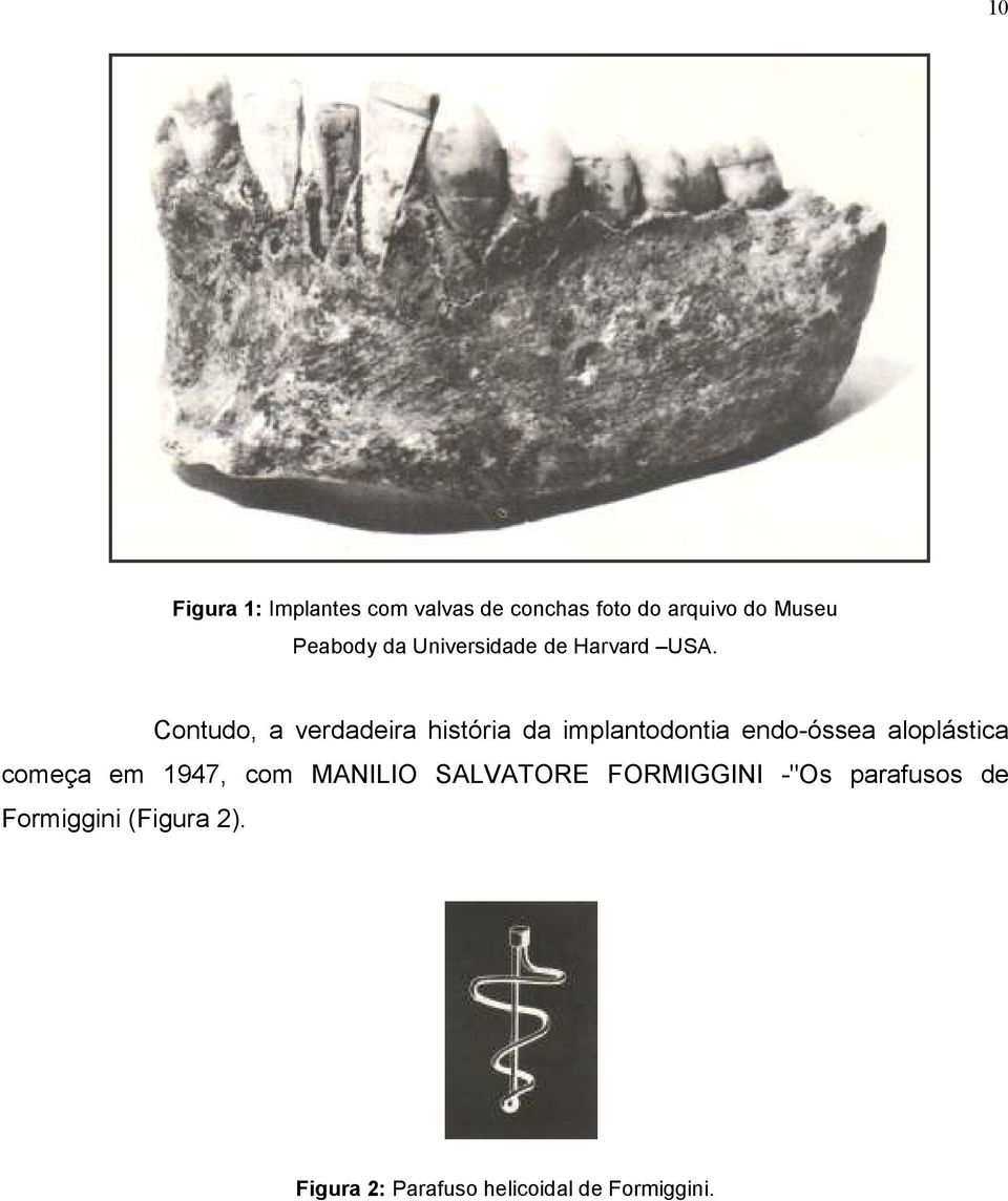 Contudo, a verdadeira história da implantodontia endo-óssea aloplástica começa