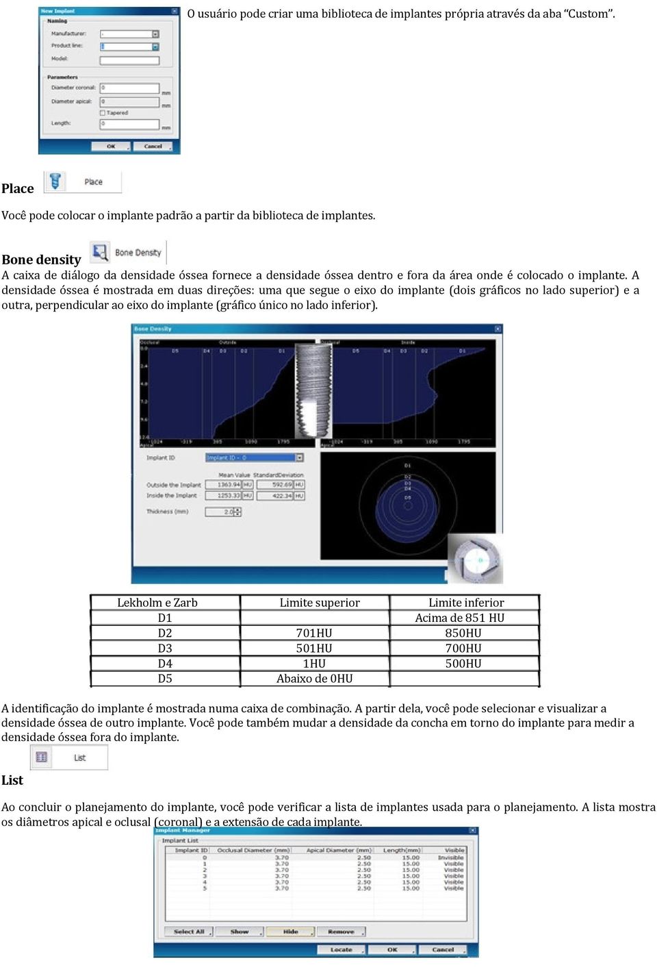 A densidade óssea é mostrada em duas direções: uma que segue o eixo do implante (dois gráficos no lado superior) e a outra, perpendicular ao eixo do implante (gráfico único no lado inferior).