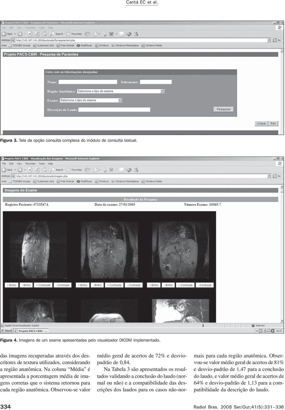 Na coluna Média é apresentada a porcentagem média de imagens corretas que o sistema retornou para cada região anatômica. Observou-se valor médio geral de acertos de 72% e desviopadrão de,8.