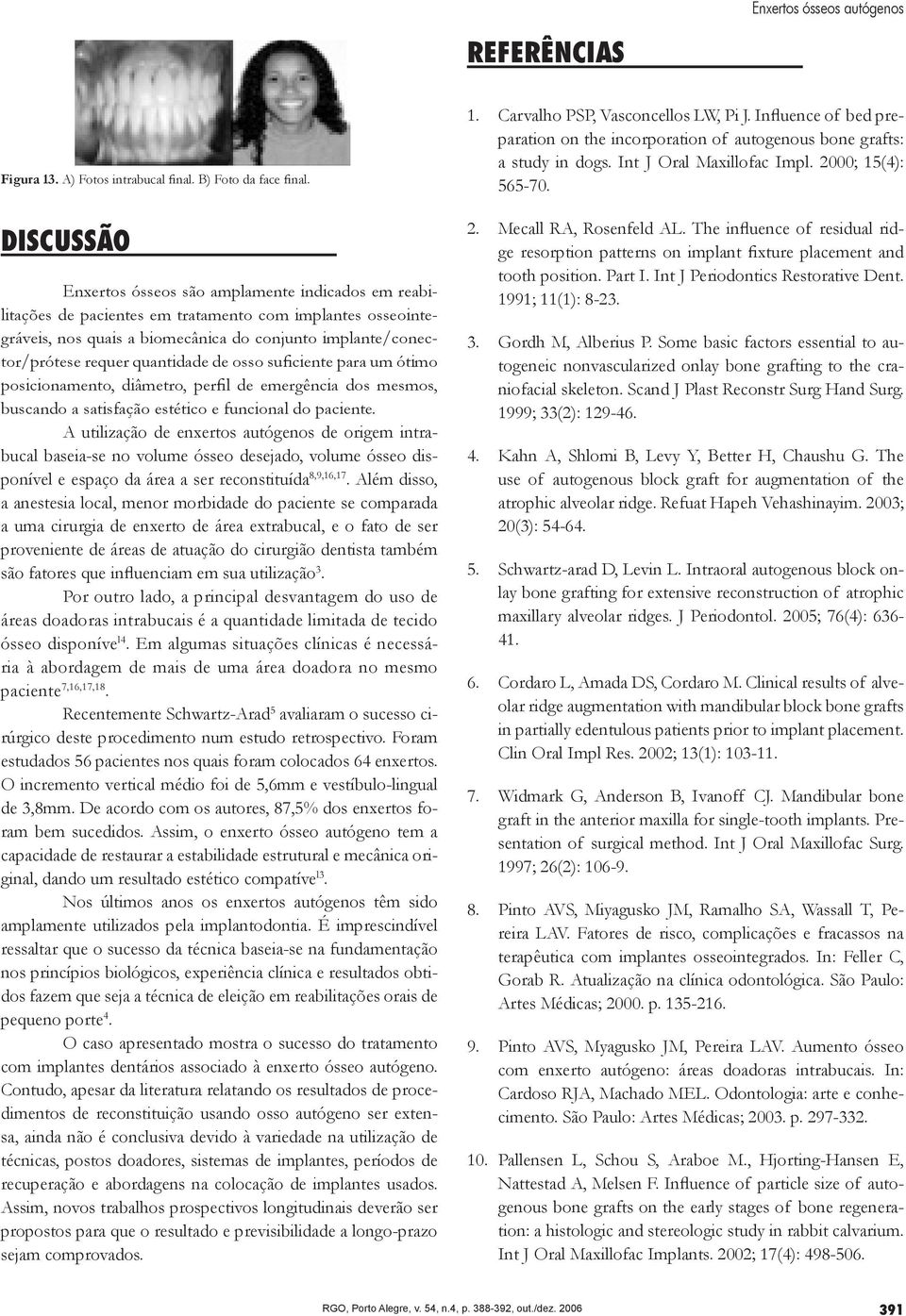 DISCUSSÃO Enxertos ósseos são amplamente indicados em reabilitações de pacientes em tratamento com implantes osseointegráveis, nos quais a biomecânica do conjunto implante/conector/prótese requer