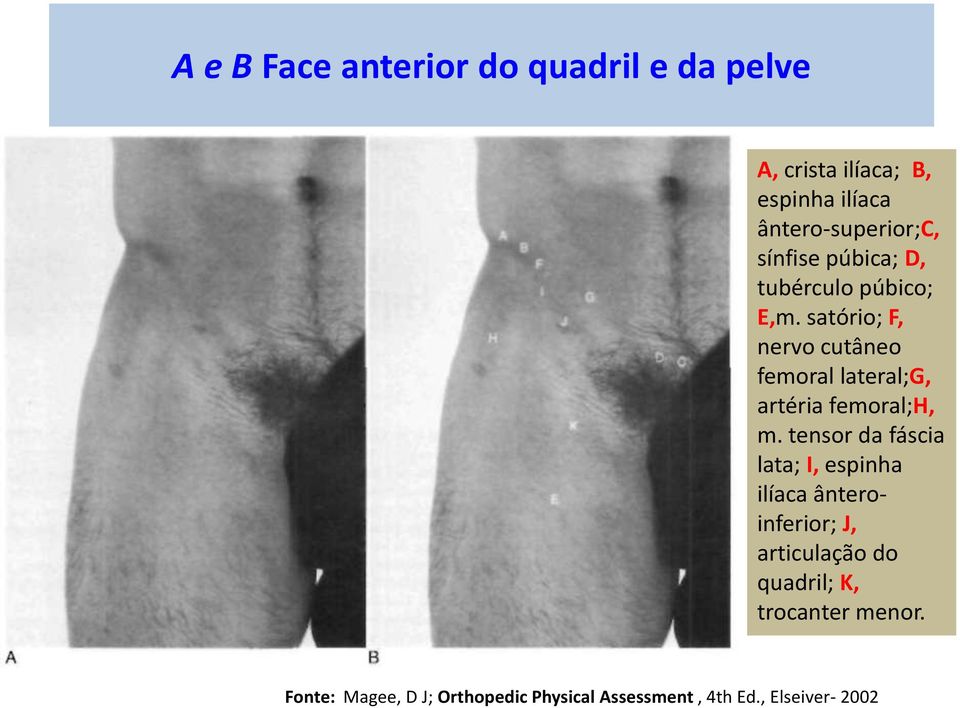 satório; F, nervo cutâneo femoral lateral;g, artéria femoral;h, m.