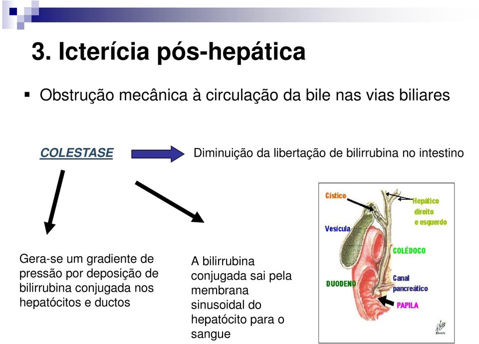 um gradiente de pressão por deposição de bilirrubina conjugada nos hepatócitos e