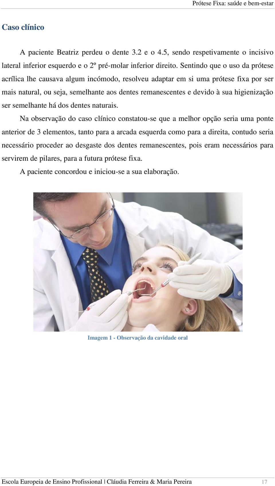 higienização ser semelhante há dos dentes naturais.