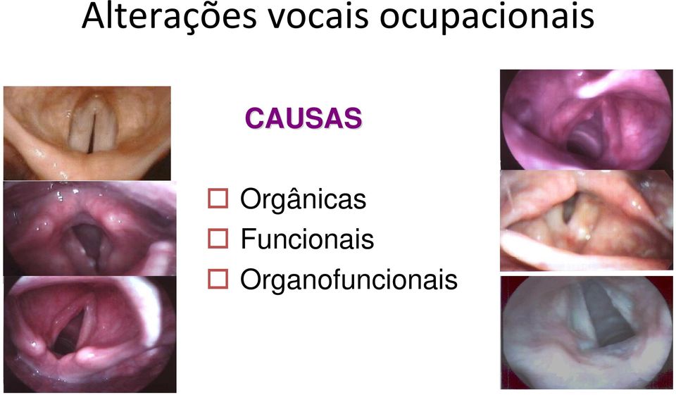 CAUSAS Orgânicas