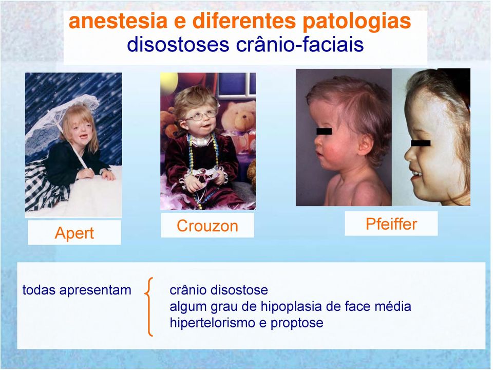 apresentam crânio disostose algum grau de