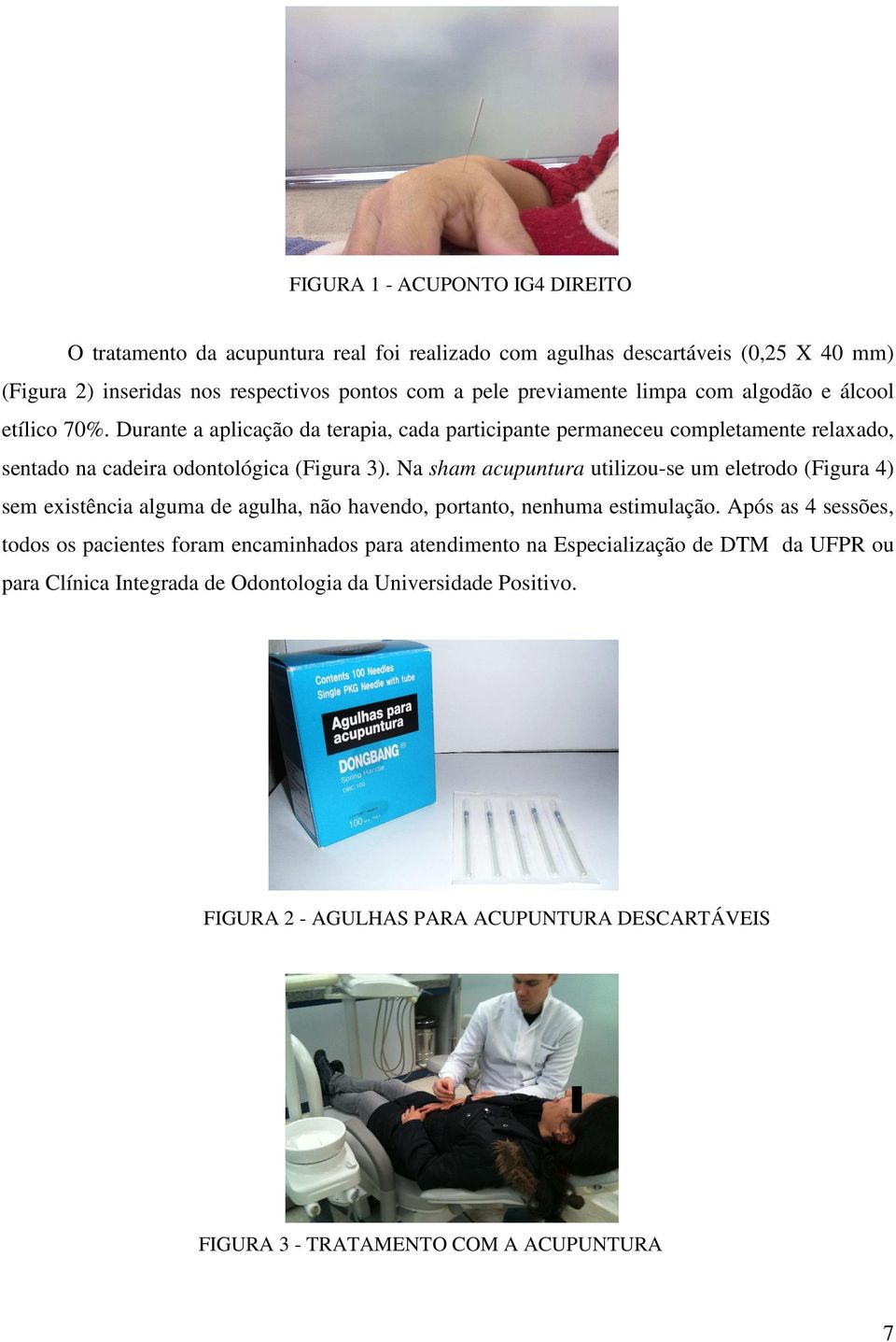 Na sham acupuntura utilizou-se um eletrodo (Figura 4) sem existência alguma de agulha, não havendo, portanto, nenhuma estimulação.