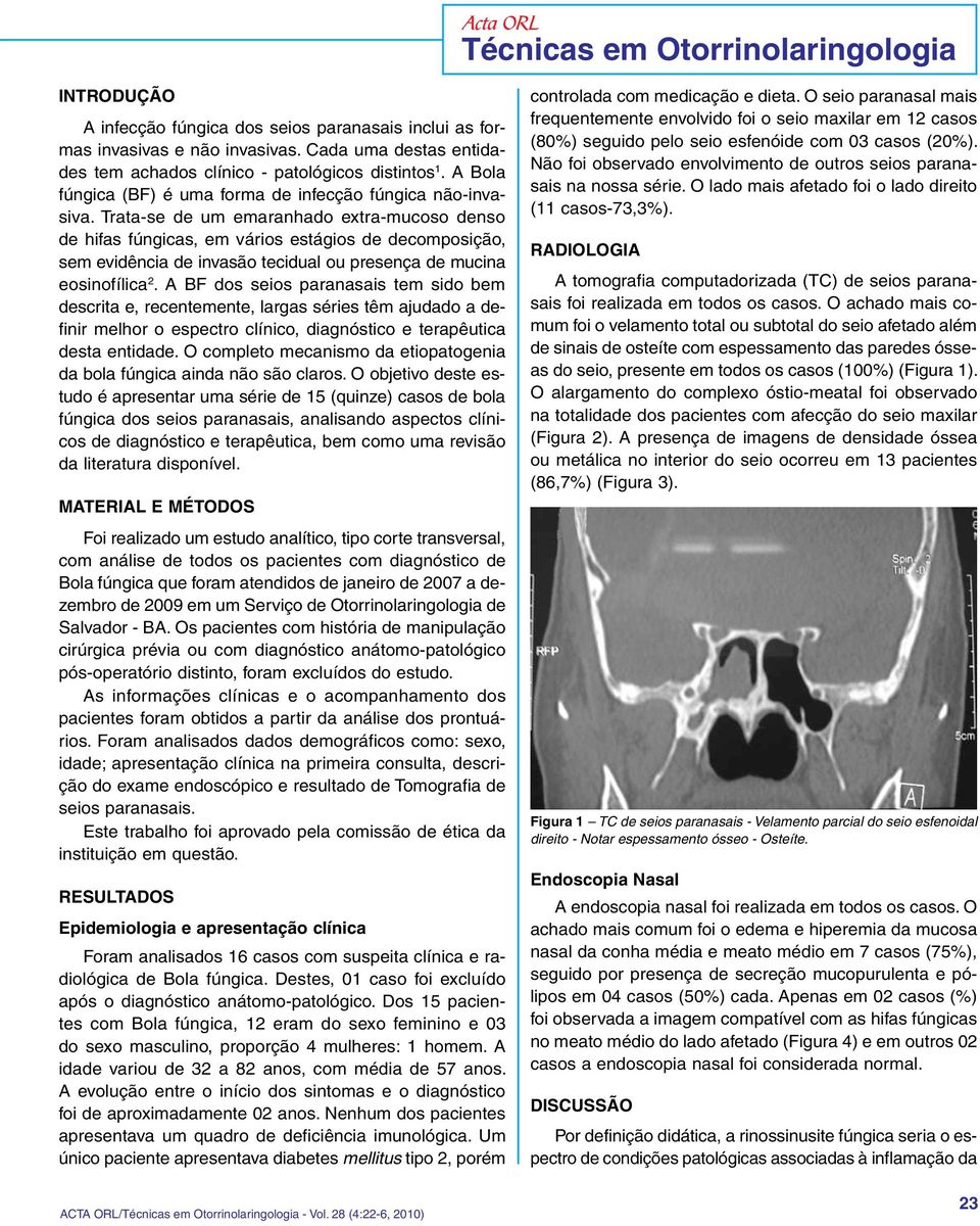 Trata-se de um emaranhado extra-mucoso denso de hifas fúngicas, em vários estágios de decomposição, sem evidência de invasão tecidual ou presença de mucina eosinofílica 2.