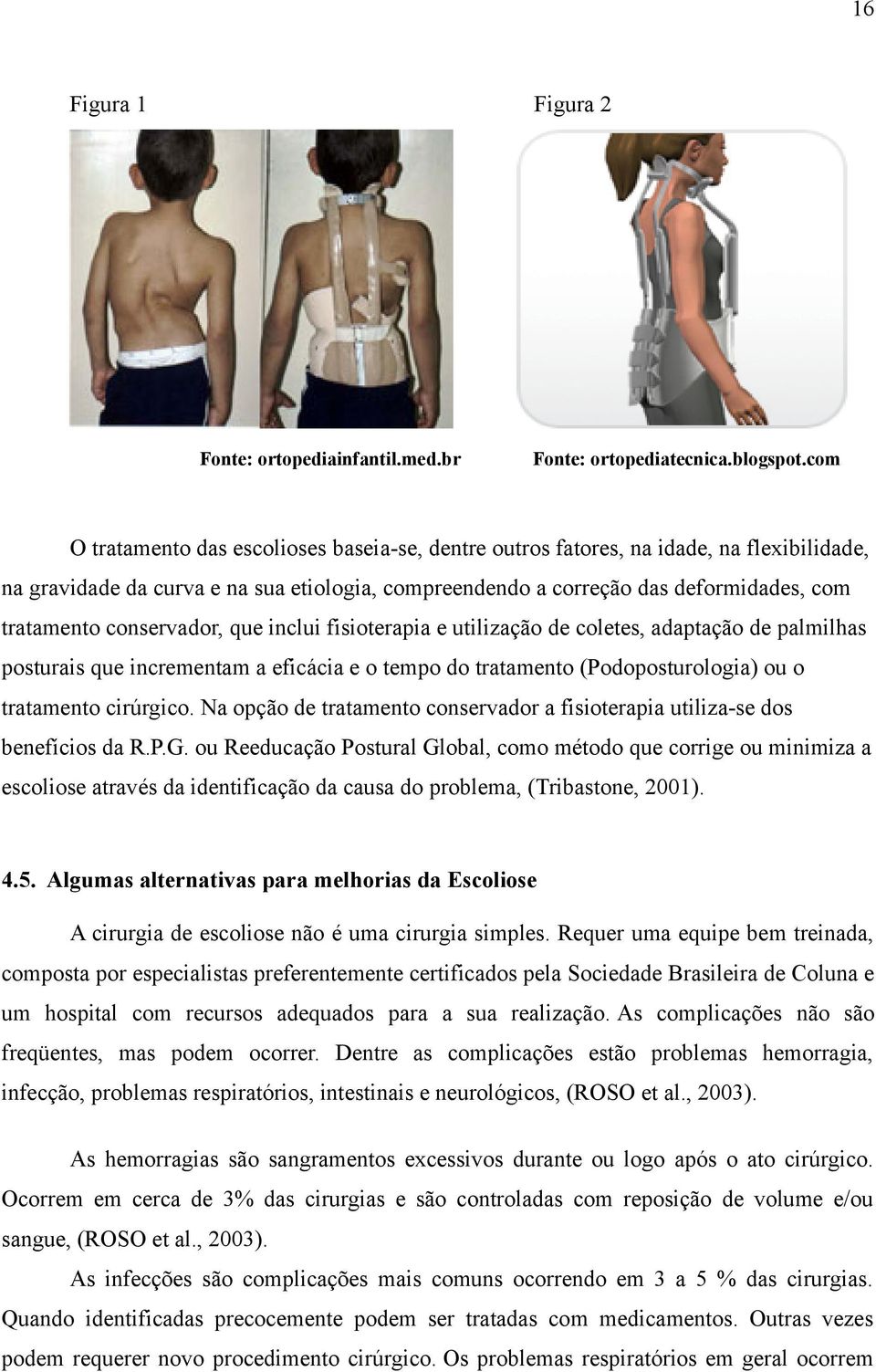 conservador, que inclui fisioterapia e utilização de coletes, adaptação de palmilhas posturais que incrementam a eficácia e o tempo do tratamento (Podoposturologia) ou o tratamento cirúrgico.