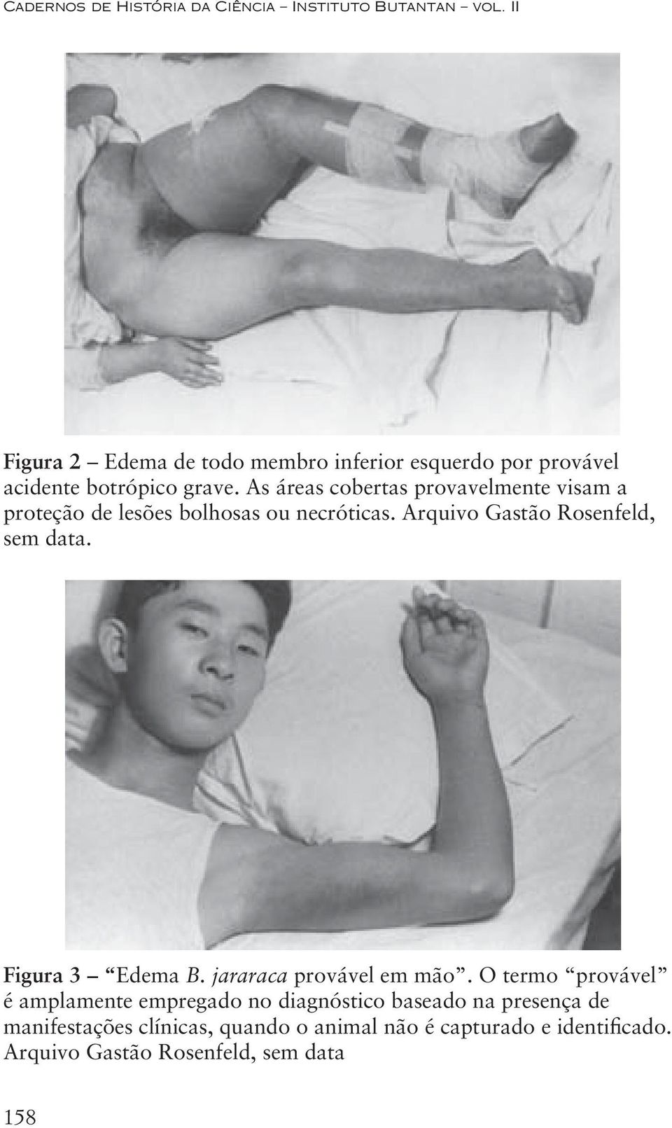 As áreas cobertas provavelmente visam a proteção de lesões bolhosas ou necróticas. Arquivo Gastão Rosenfeld, sem data.