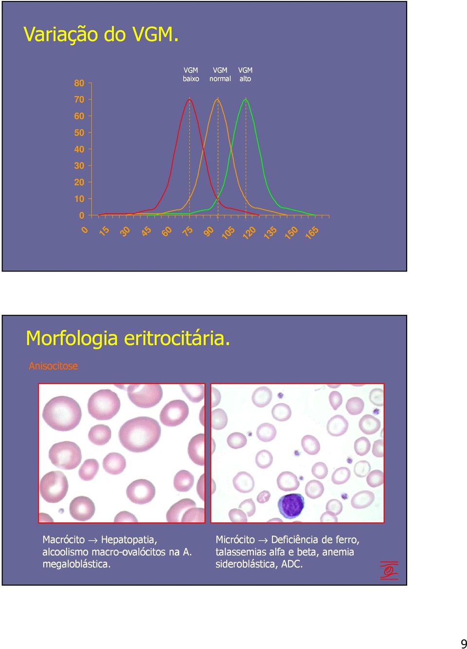 120 135 150 165 Morfologia eritrocitária.