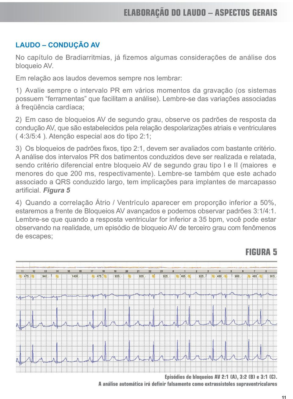 Lembre-se das variações associadas à freqüência cardíaca; 2) Em caso de bloqueios AV de segundo grau, observe os padrões de resposta da condução AV, que são estabelecidos pela relação despolarizações