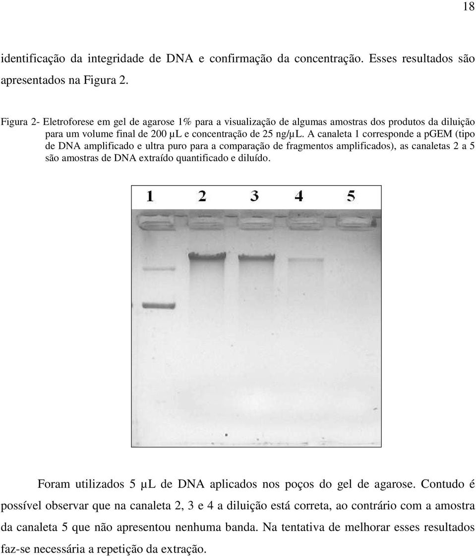 A canaleta 1 corresponde a pgem (tipo de DNA amplificado e ultra puro para a comparação de fragmentos amplificados), as canaletas 2 a 5 são amostras de DNA extraído quantificado e diluído.