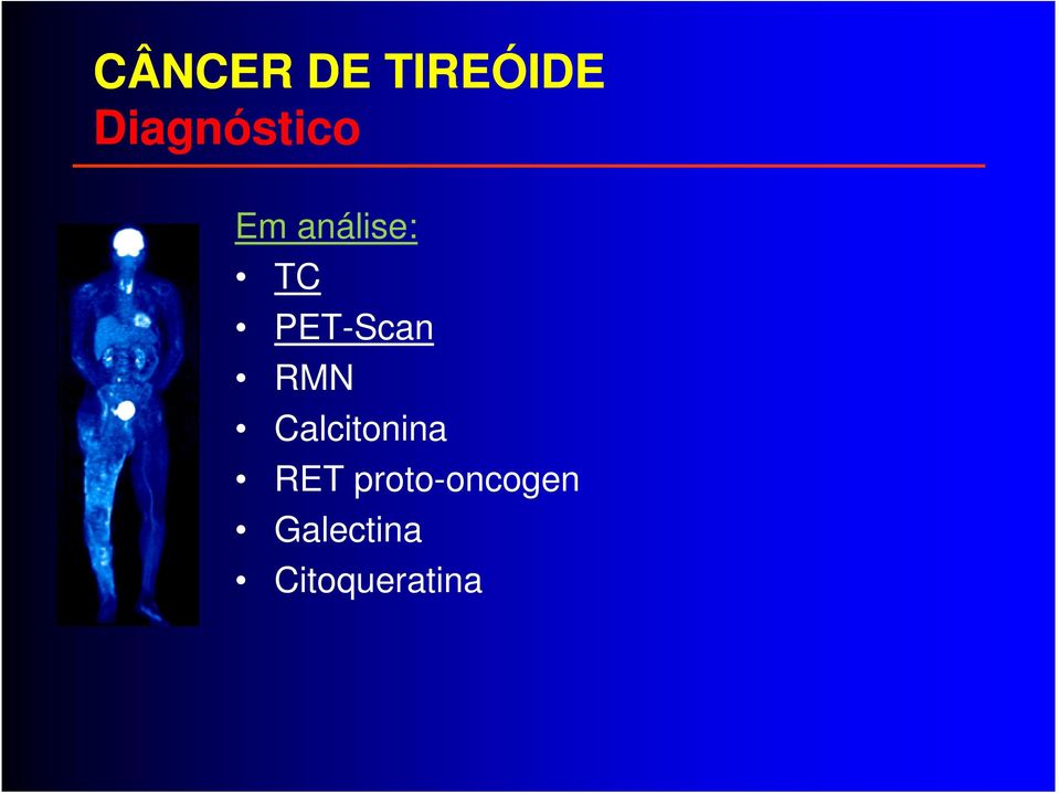 PET-Scan RMN Calcitonina