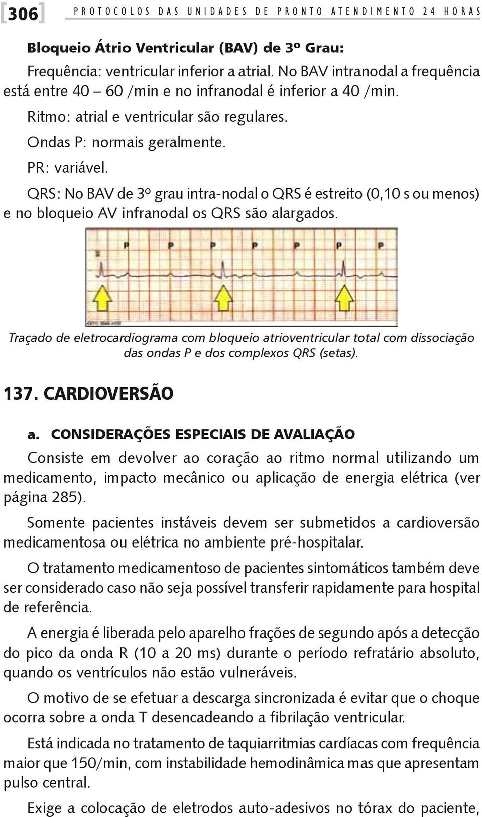 QRS: No BAV de 3º grau intra-nodal o QRS é estreito (0,10 s ou menos) e no bloqueio AV infranodal os QRS são alargados.