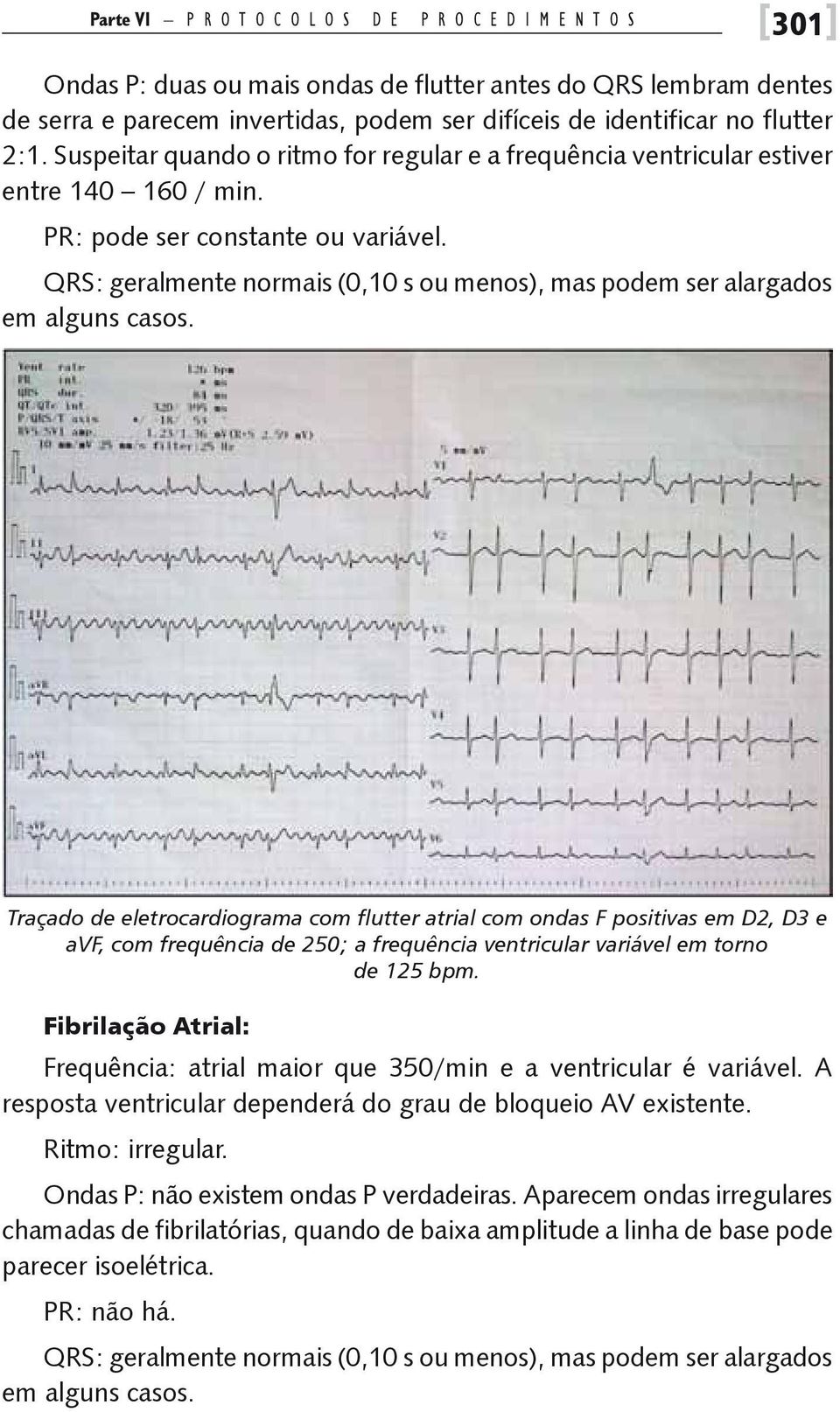 QRS: geralmente normais (0,10 s ou menos), mas podem ser alargados em alguns casos.