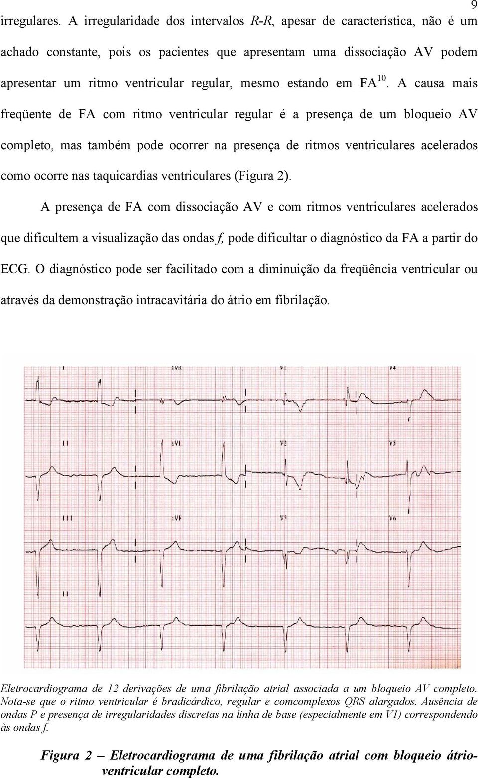 estando em FA 10.