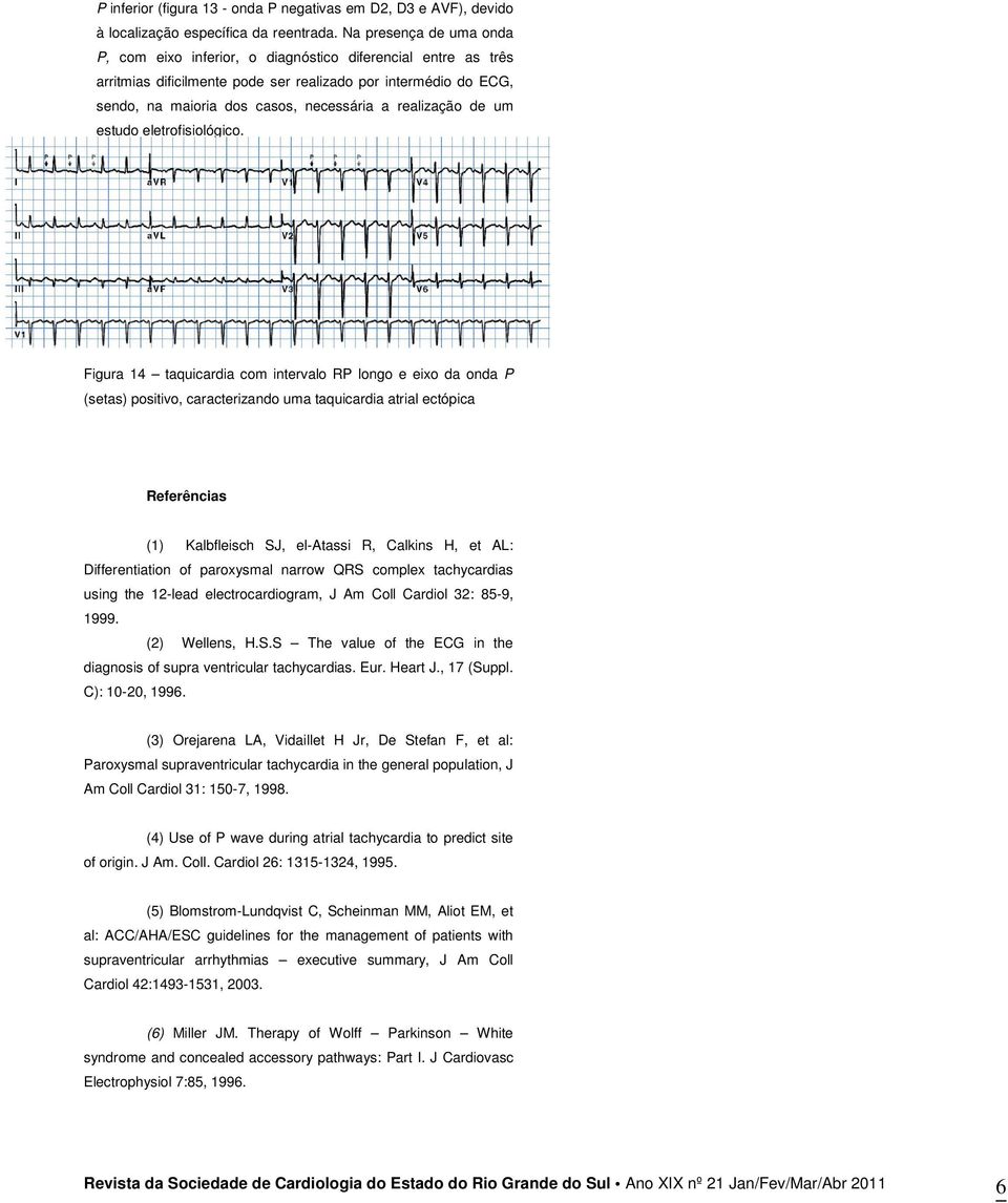 realização de um estudo eletrofisiológico.