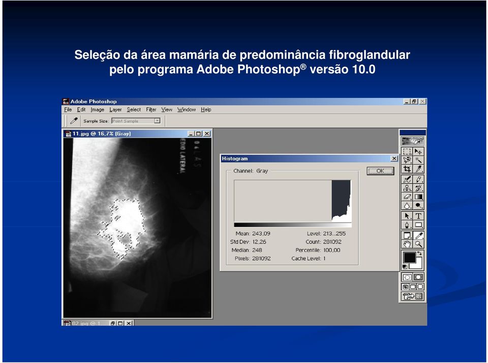 fibroglandular pelo