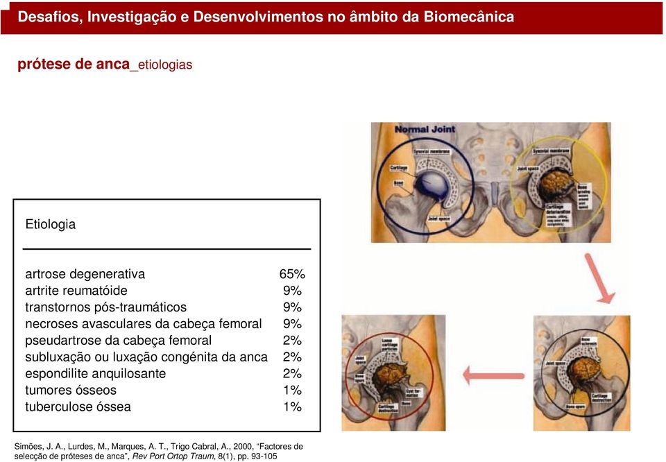 anquilosante 2% tumores ósseos 1% tuberculose óssea 1% processo degenerativo da cartilagem: artrose Simões, J. A.