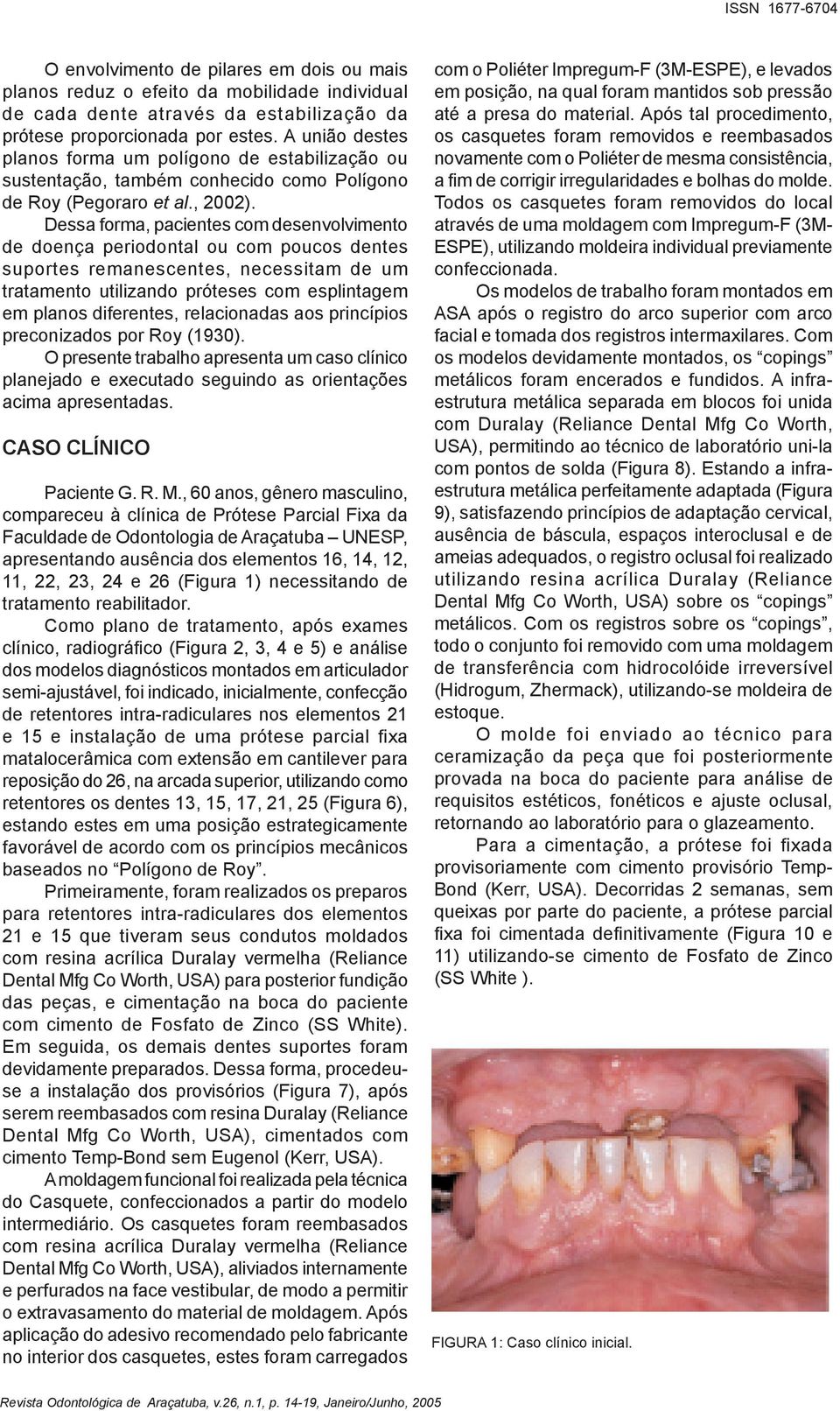 Dessa forma, pacientes com desenvolvimento de doença periodontal ou com poucos dentes suportes remanescentes, necessitam de um tratamento utilizando próteses com esplintagem em planos diferentes,