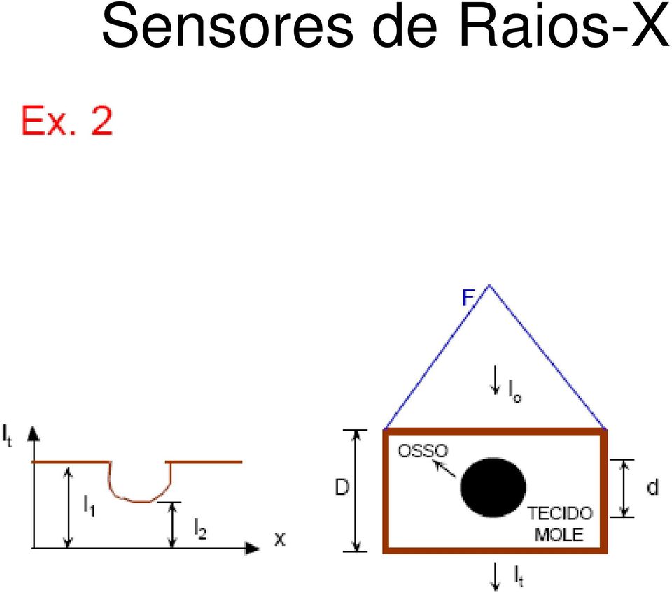 Raios-X