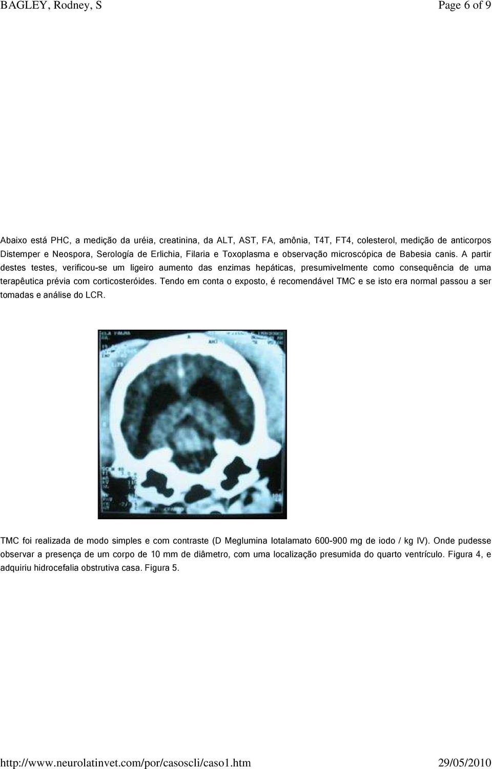 A partir destes testes, verificou-se um ligeiro aumento das enzimas hepáticas, presumivelmente como consequência de uma terapêutica prévia com corticosteróides.