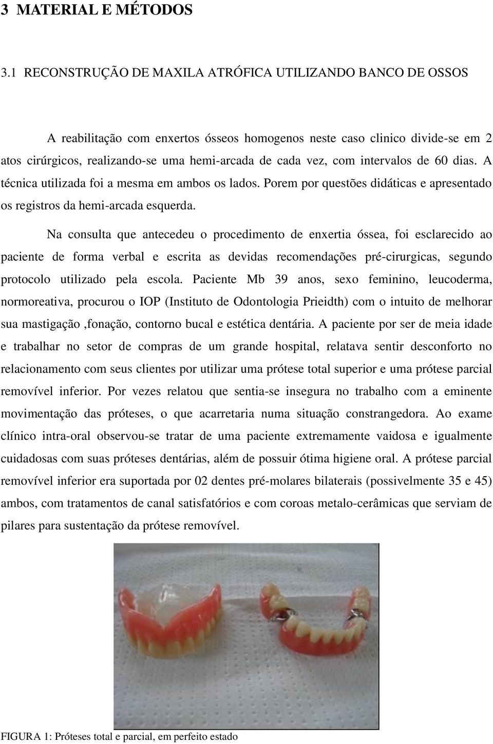 com intervalos de 60 dias. A técnica utilizada foi a mesma em ambos os lados. Porem por questões didáticas e apresentado os registros da hemi-arcada esquerda.